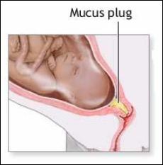 loss of mucus plug  labor