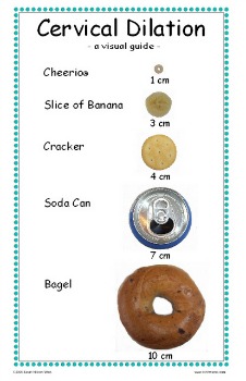 Fingertip Dilation Chart